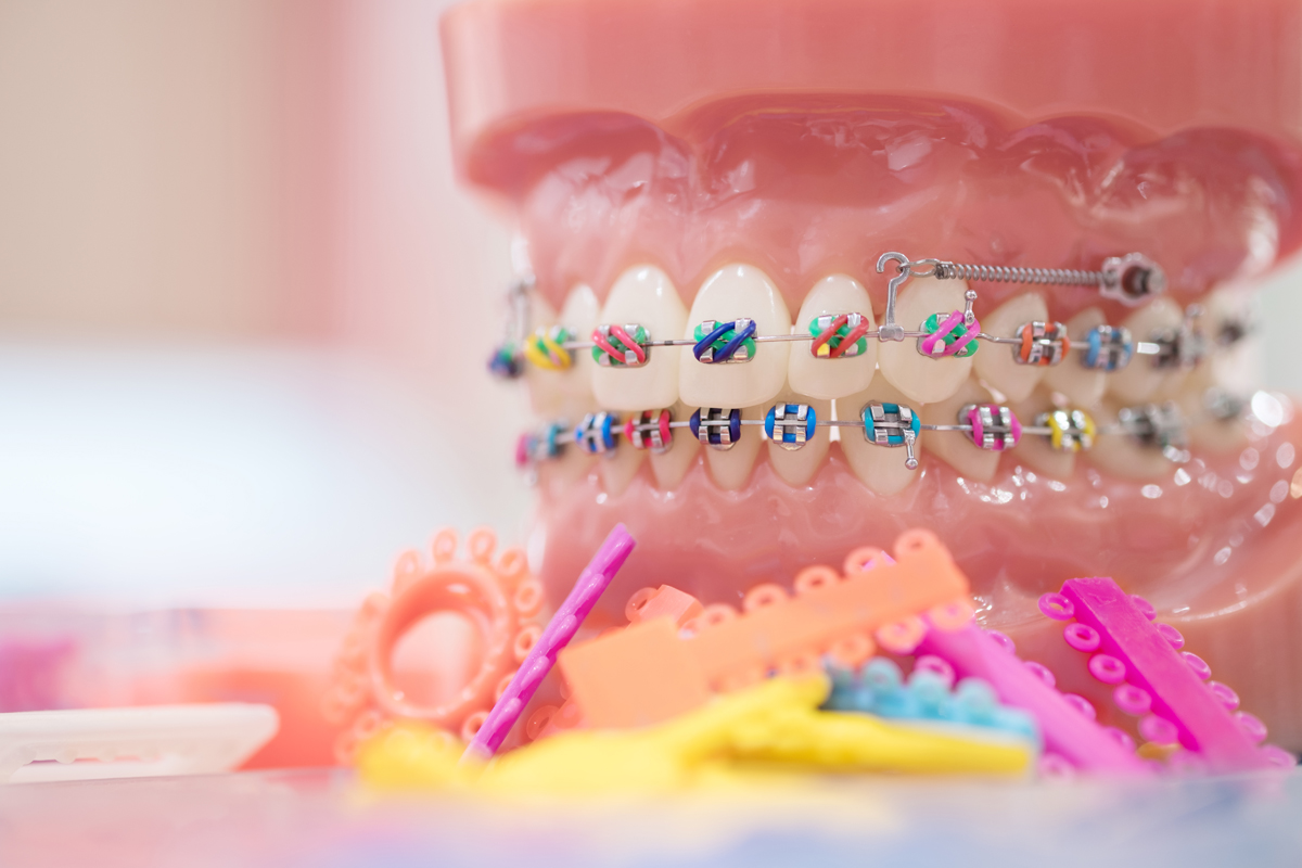Slider 1 Çocuklarda Ortodonti Adana - Dr. Dt. Cemal Şişman